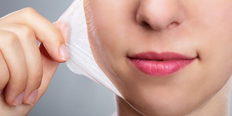 Identify Different Types of Chemical Peels