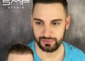 Embrace a Bold New Look with Scalp Micropigmentation