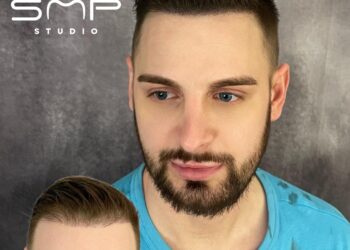 Embrace a Bold New Look with Scalp Micropigmentation